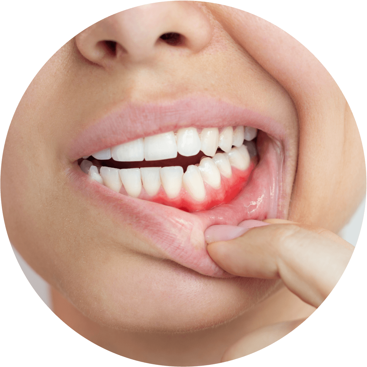 Best Dental Crowns Tri-Cities